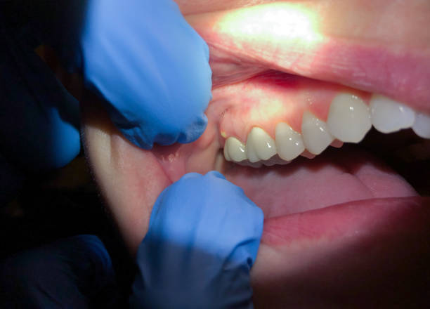 Best Orthodontic Emergency Dentist in Enon, OH